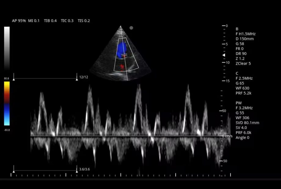 Diagnostic Color Doppler Ultrasound