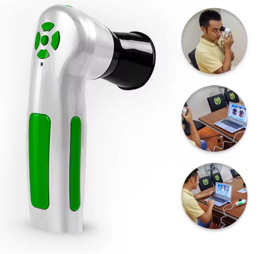 Iriscope Digital Eye Test Iridiology