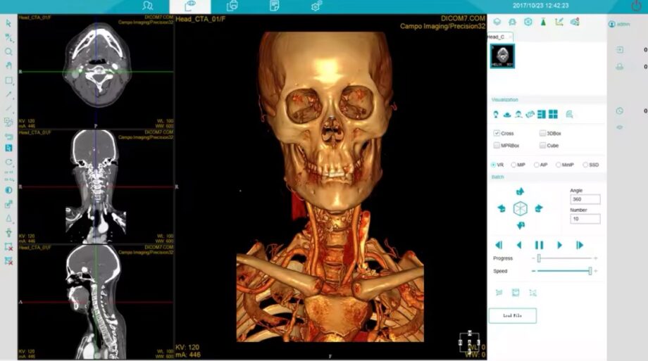 Smart Instrument Medical Tomography Computed 1.5T MRI Digital Scan
Imaging System