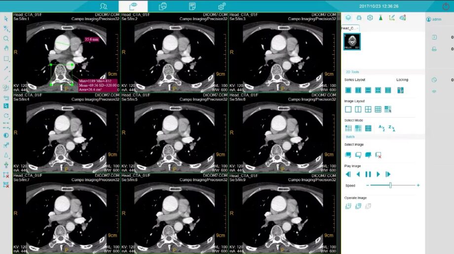 Smart Instrument Medical Tomography Computed 1.5T MRI Digital Scan
Imaging System